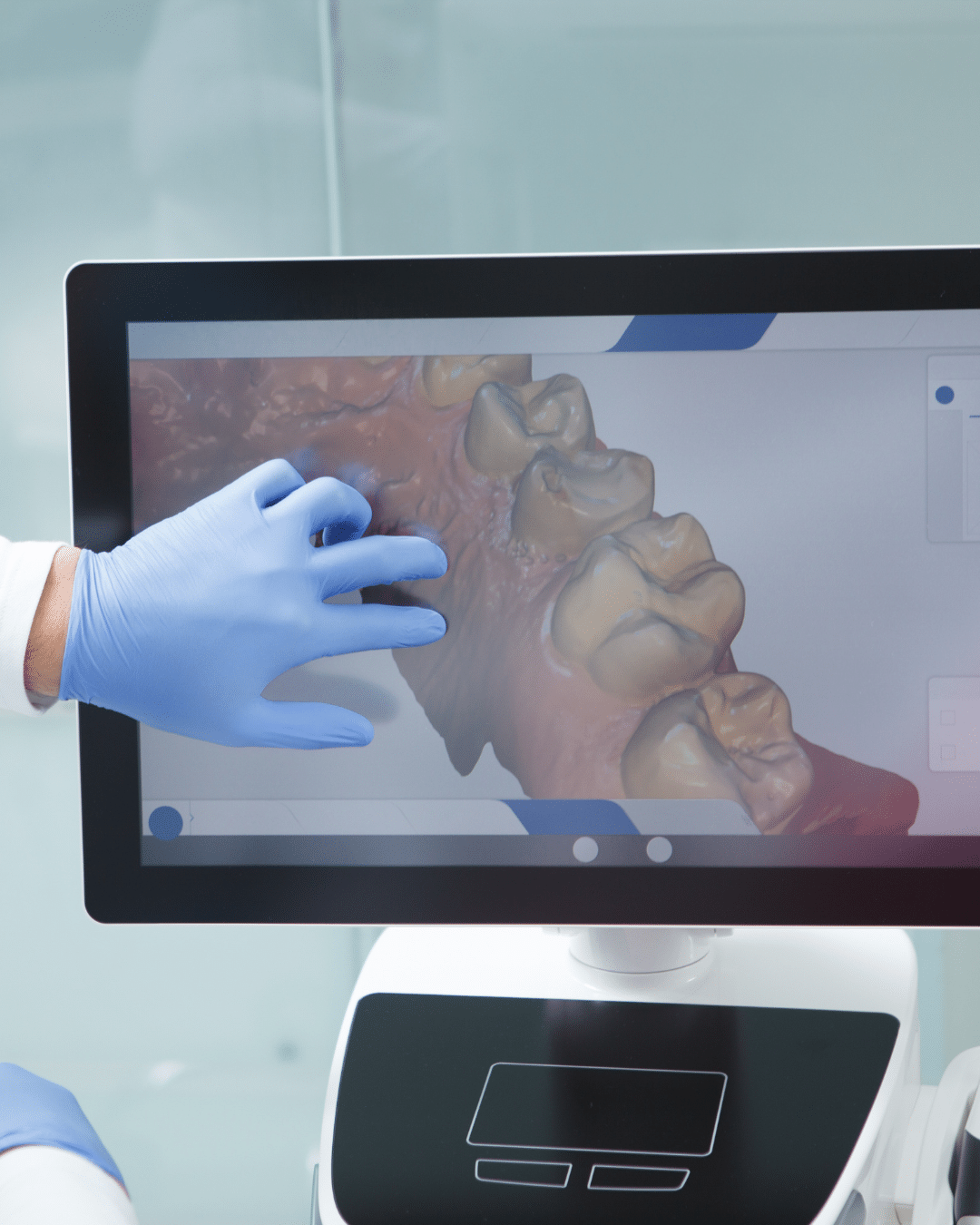 Digital Dental Scanning Minahan Orthodontics in Olney, MD